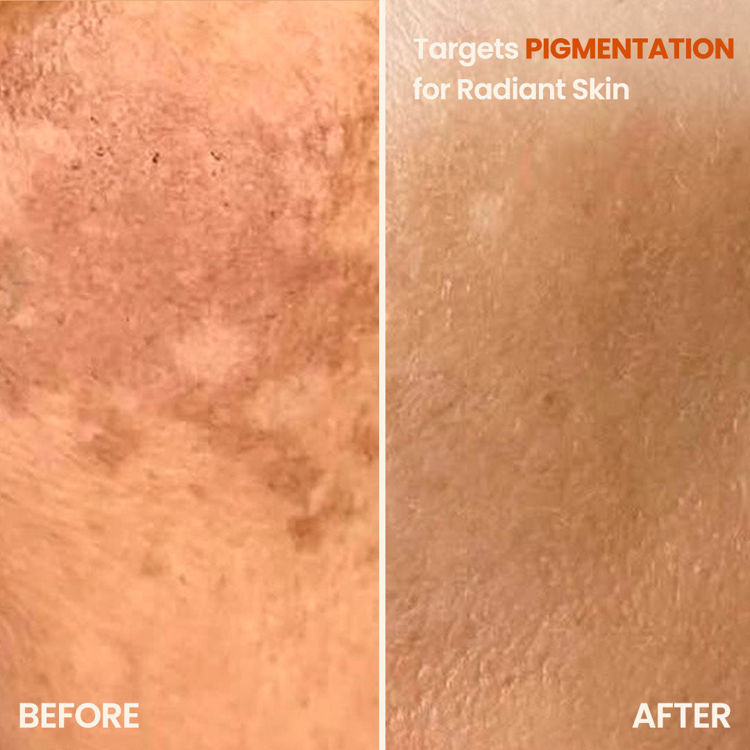 Bring It Back - 7.5% Vitamin C & 2% Niacinamide Serum